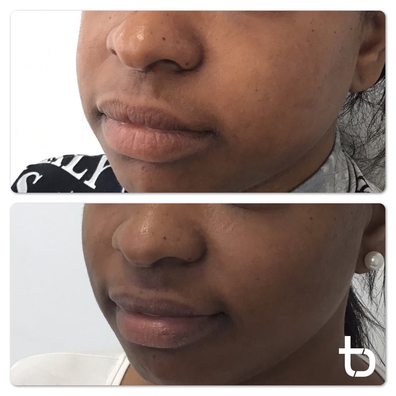 A close up look at our clients' before and after results.