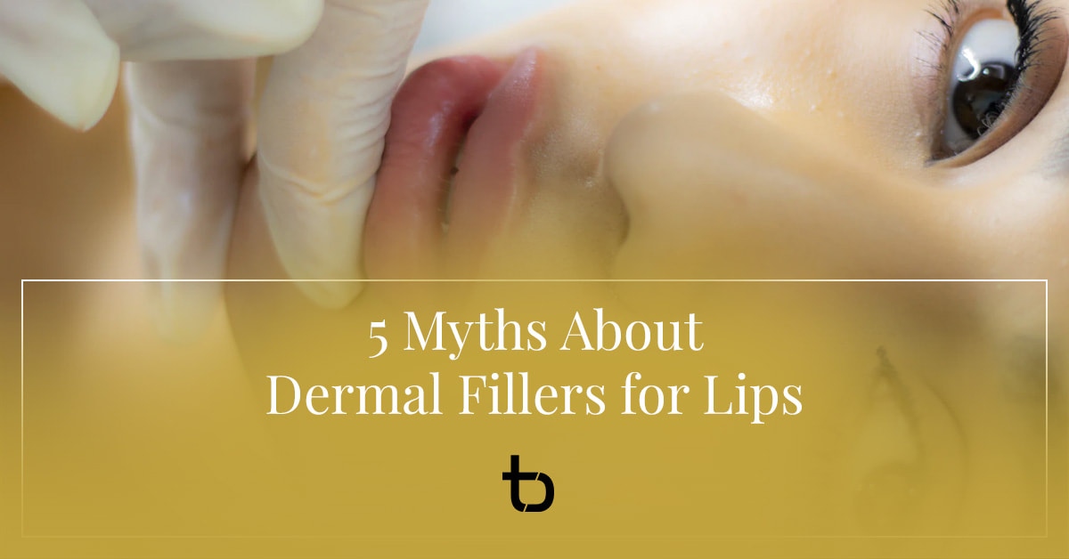 5 Myths About Dermal Fillers for Lips